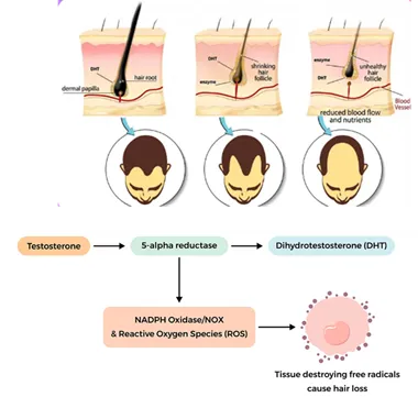 Alopecia Graphic image