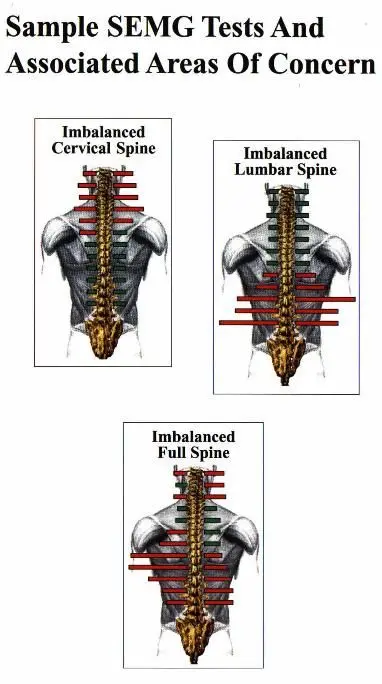 Sample SEMG Tests and Associated Areas of Concern