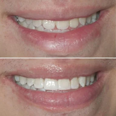 Cosmetic Dentist Brookline, MA