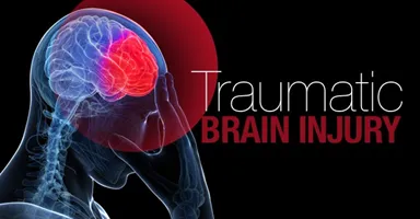 Tramuatic Brain Injury Stock Photo