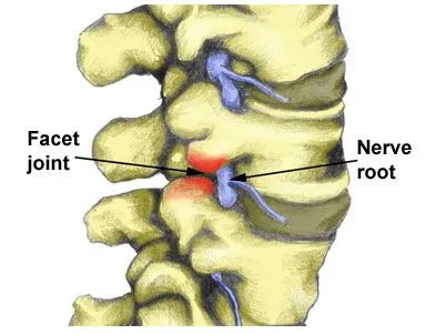 facet-joint