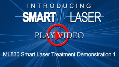 SmartLaserVideo11-700x394.png