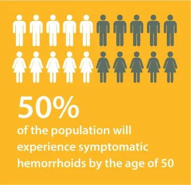 50% of the population will experience symptomatic hemorrhoids by the age of 50