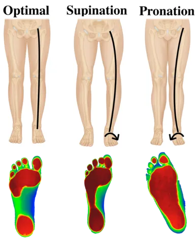 Supination of the feet