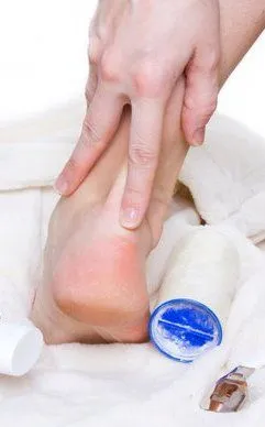 Lafayette Podiatrist | Lafayette Calluses | LA | Dr. Mark F. Ellis, DPM |