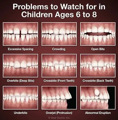 orthodontic-problems