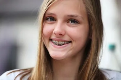 teen girl smiling has braces, orthodontics Kearney, NE orthodontist