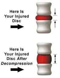 disc_before_and_after.jpg