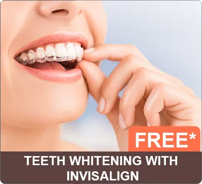 Free Teeth Whitening with Invisalign