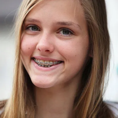 blond teen girl with braces smiling, Orthodontics Melrose, MA