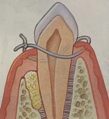Periodontal Surgeries | Dentist in Reston, VA
