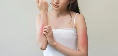 woman looking her arm white sraching it.