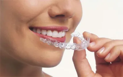 invisalign_pic.jpg