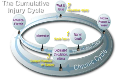 Active Release Cycle
