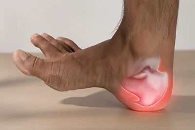 Heel-Spurs-Treatment-in-Joliet-and-Channahon-IL