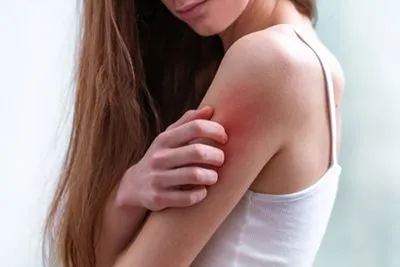 Woman with red skin rash on arm