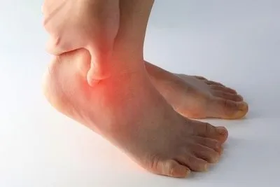 Illustration of tarsal tunnel syndrome