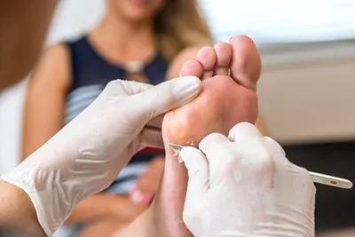 Podiatrist removing callus from patient's foot