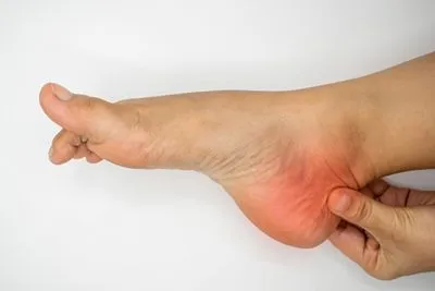 Foot with heel pain highlighted in red indicating pain