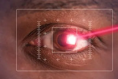 Advanced-PRK-in-NYC-and-Manhattan-NY