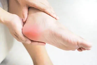 Plantar-Fasciitis-Treatment-in-Ashland-KY