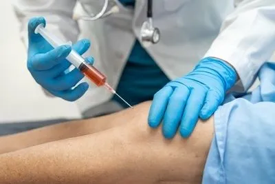 Procedure of PRP Injections