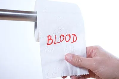 Toilet tissue showing the word "Blood" for gastrointestinal bleeding awareness