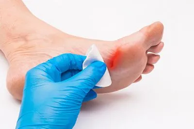 Podiatrist treating foot wound during clinical visit