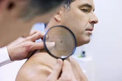 Skin-Cancer-Screening-in-Bend-OR