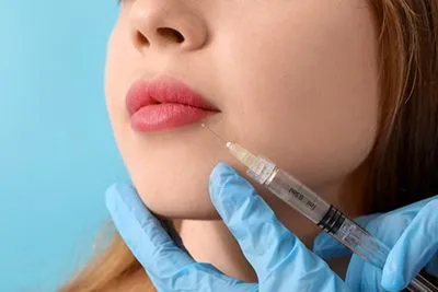 Dermal Fillers