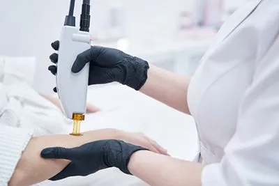 Laser hair removal procedure on female client's hands