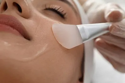 Woman face with chemical peels filling