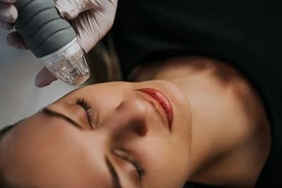 Dermatologist performing microneedling on woman’s face
