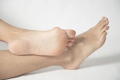 Illustration of bunion condition on a person