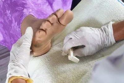 Diabetic Foot Care in Ridgefield, CT Serving Danbury & Redding, CT