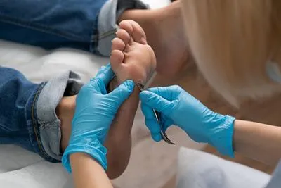 Podiatrist using a nipper to trim thick calluses on patient’s foot