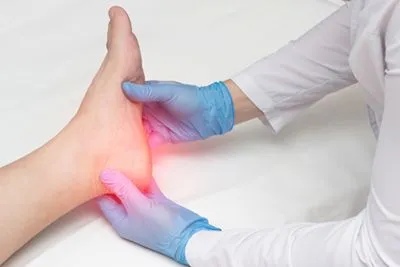 Doctor examining Plantar Fasciitis 