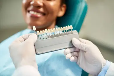 Photograph of woman smiling behind a set of Veneers for color matching, Chicago, IL