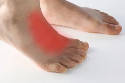 Foot pain caused by extensor tendonitis in a man