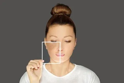 Womans face with Hyperpigmentation