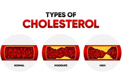 Cholesterol