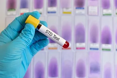 STD-Screening-in-Mountain-View-CA