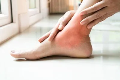 Woman holding her foot and ankle in pain