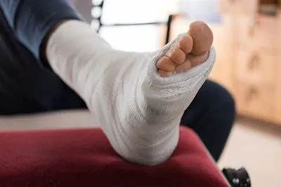 Persons foot with fractures and bondage