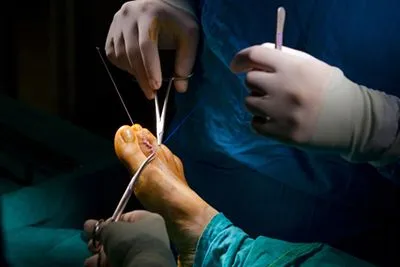 Podiatrist in operating room during foot surgery