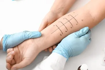 Skin allergy testing on clinic table