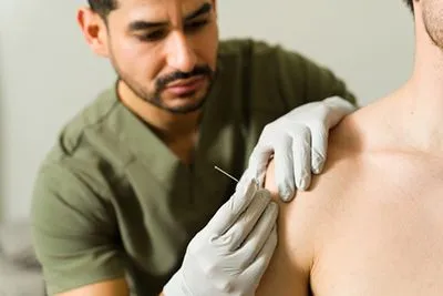 Man receiving dry needling therapy for shoulder pain