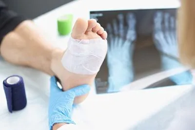 Foot specialist reviewing X-ray while examining patient's foot