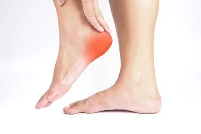 Woman experiencing heel pain from plantar fasciitis