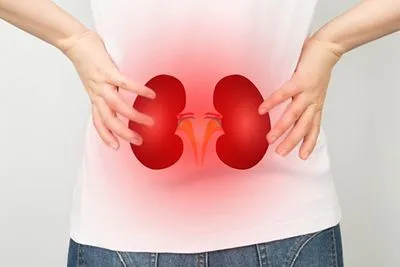 Illustration of Kidney Disease